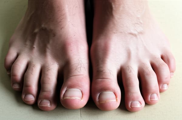A close-up, realistic image of a pair of masculine, strong, and well-proportioned feet resting naturally on a neutral surface. The feet have a slightly wider shape with a defined arch, a dominant big toe, and shorter toes that gradually decrease in length. The skin is slightly textured with subtle natural details like faint veins, clean short nails, and slightly thickened skin on the heels and the tips of the toes, suggesting strength and activity. The lighting is soft and neutral, highlighting the contours and making the overall appearance virile and realistic.

Very very masculine, style Chav
