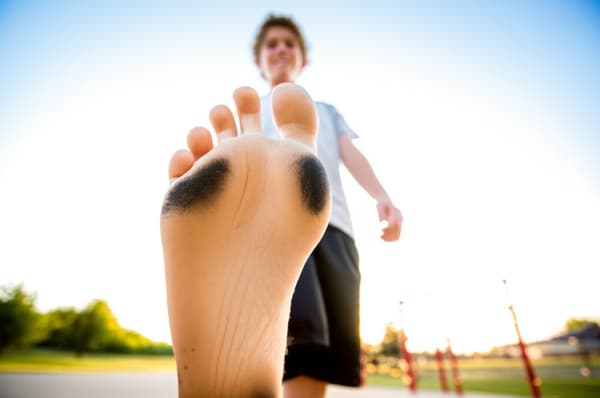 Young smiling with black and brown soles indicating extensive barefoot play